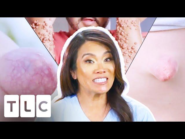 Every BEST Lump, Bump, Cyst, Pop & More Seen On Dr Pimple Popper!