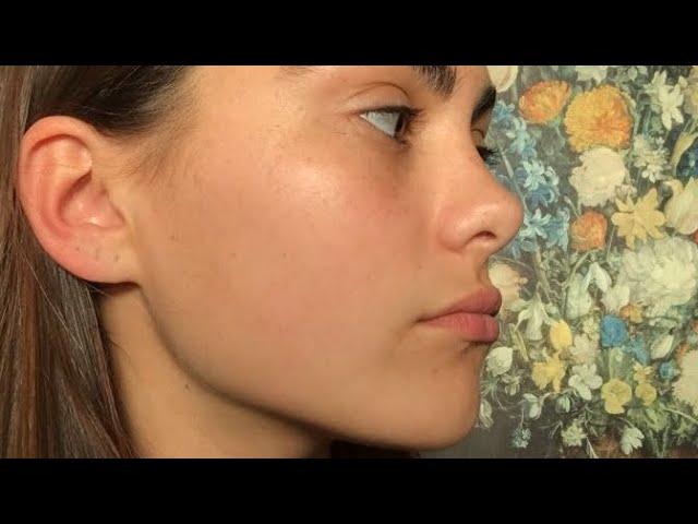 ღ your nose bridge is so smooth and sloped! ~ nasal hump reduction rhinoplasty procedure 