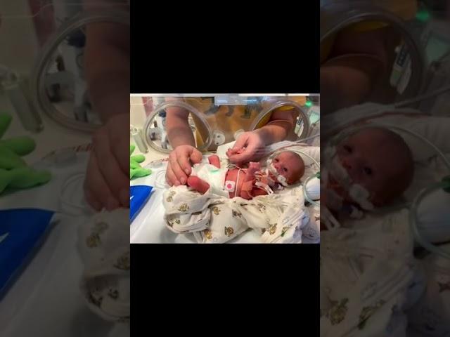 First time holding our 28 week preemie daughters. #preemiebaby
