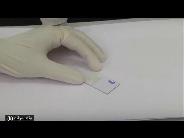 Direct faecal smear
