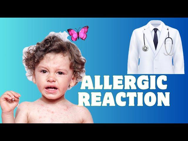 How to Understand & Manage Allergic Reaction at Home #baby #allergicreaction