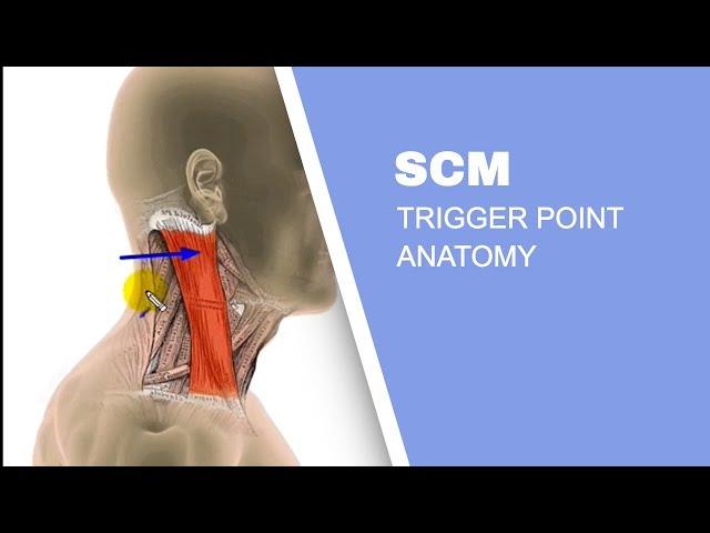 Sternocleidomastoid Muscle (SCM) Trigger Points