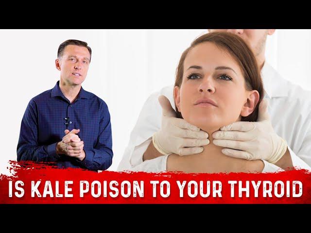 Is Kale A Poison To Your Thyroid Problems Or An Anti-Poison? – Dr. Berg