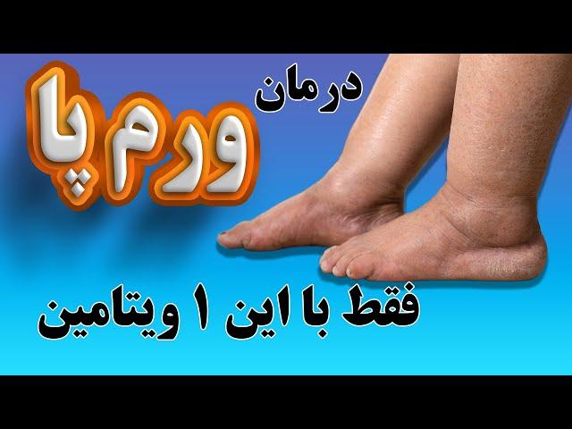 فقط با این ویتامین معجزه آسا برای همیشه با ورم پا خداحافظی کن