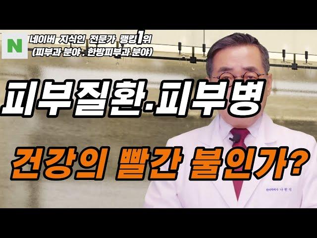 피부질환,피부병은 건강에 문제가 있어 발생하는 증상인가요?