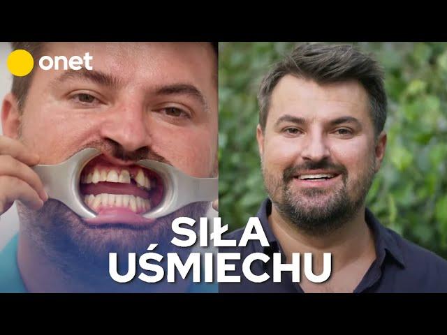 Metamorfoza uśmiechu Łukasza | Siła uśmiechu #2