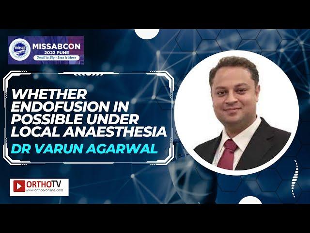 Whether Endofusion in Possible under Local Anaesthesia - Dr Varun Agarwal
