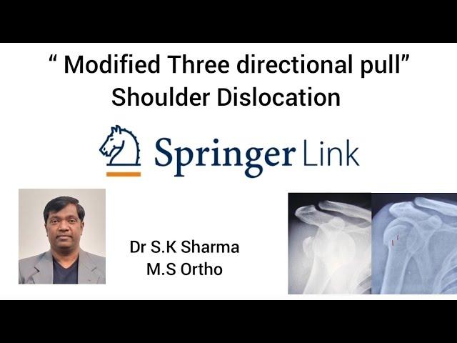 “three directional pull”method of shoulder relocation #Dr S.K Sharma M.S Ortho