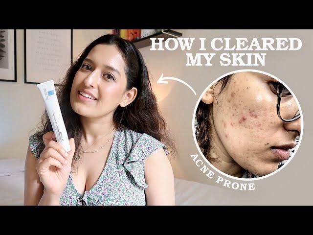 My 3 Step Evidence-Based Skincare Routine As A Doctor | HOW I CLEARED MY ACNE | Affordable, Easy..