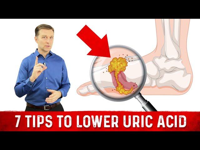 7 Tips to Lower Uric Acid – Dr. Berg