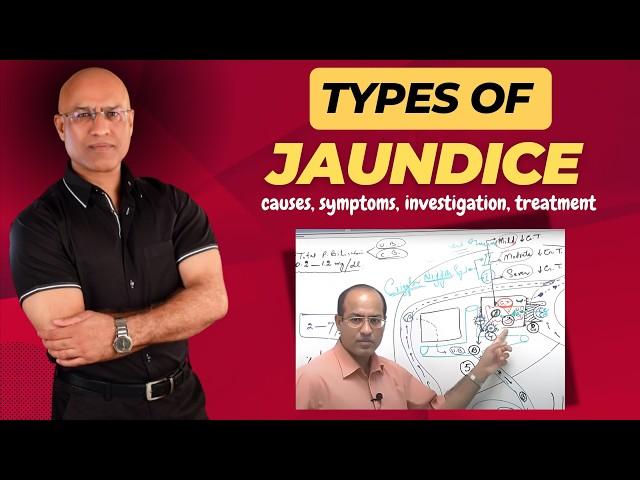 Types Of Jaundice | Causes, Symptoms & Treatment | Dr Najeeb