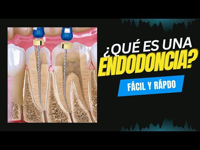 ¿Qué es una endodoncia dental? Fácil y rápido