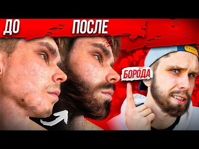 Лучший Способ Отрастить МУЖИЦКУЮ БОРОДУ! МИНОКСИДИЛ (minoxidil)