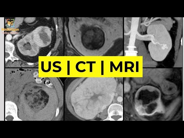 Imaging of Renal Masses [ALL YOU NEED TO KNOW] | Dr. Daniel J. Kowal (RadiologistHQ)