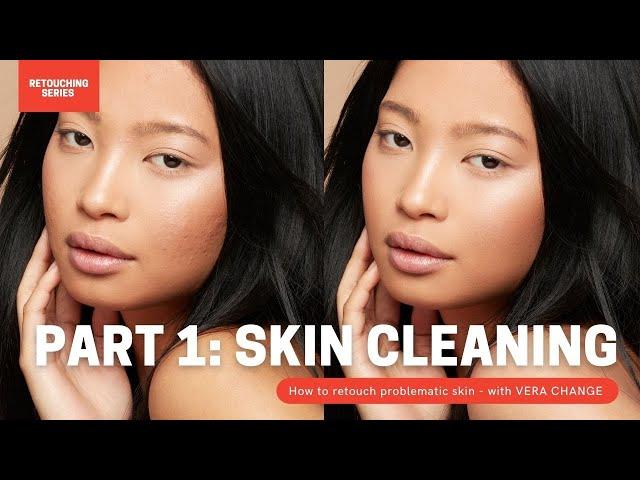 Retouching problematic skin PART 1: CLEANING // High end skin retouching series with Vera Change