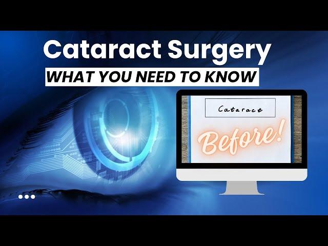 BEFORE Cataract Surgery Instructions