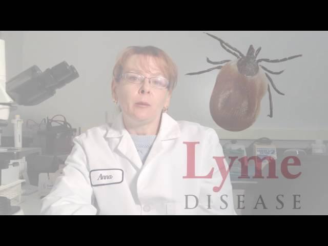 Lyme Disease Research | Dr. Rath Research Institute - Anna Goc, Ph.D.