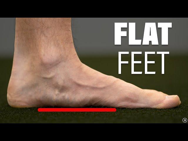 You Don’t Need To Fix Your Flat or Pronated Feet