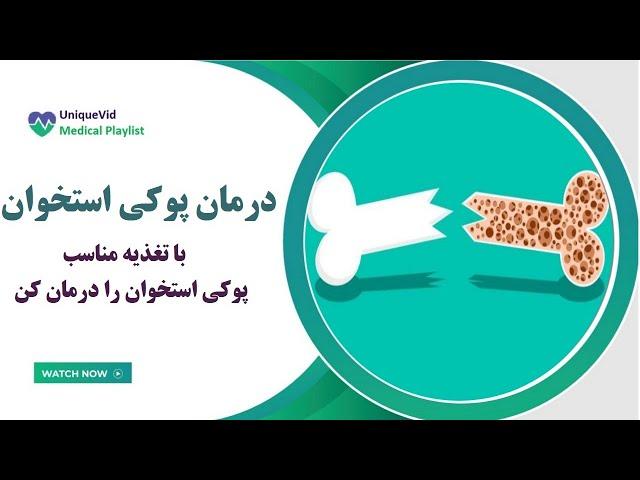 درمان پوکی استخوان با تغذیه مناسب