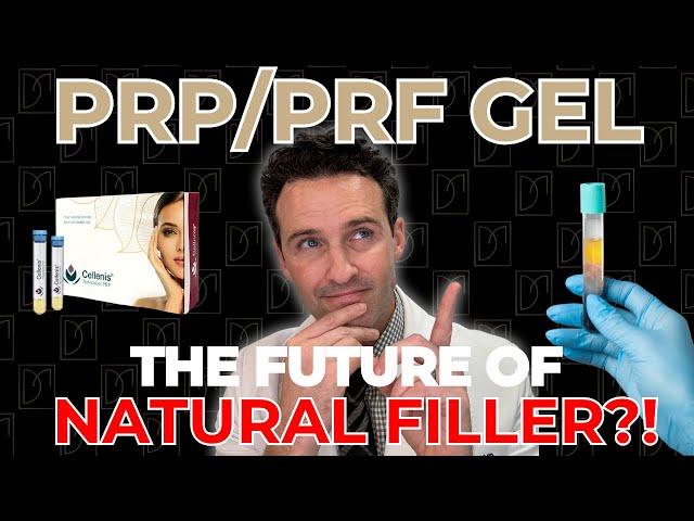 PRP / PRF GEL: The Future of NATURAL Filler?