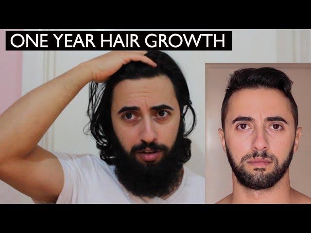 GROWING HAIR ONE YEAR | MY EXPERIENCE & TIPS | Harry Ax