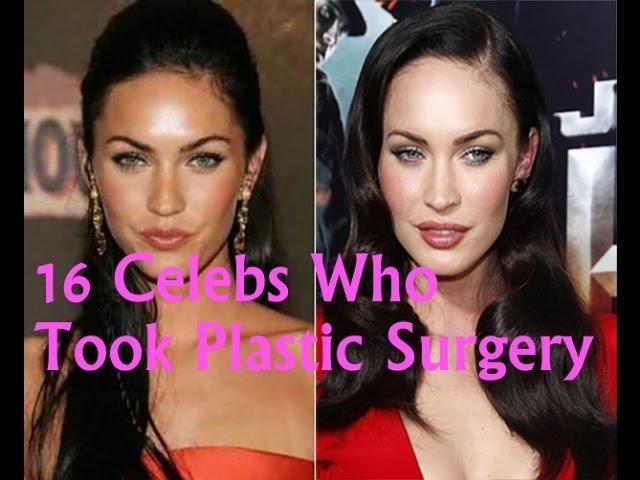 Celebrity Gossip-16 Celebs Who Took Plastic Surgery Too Far