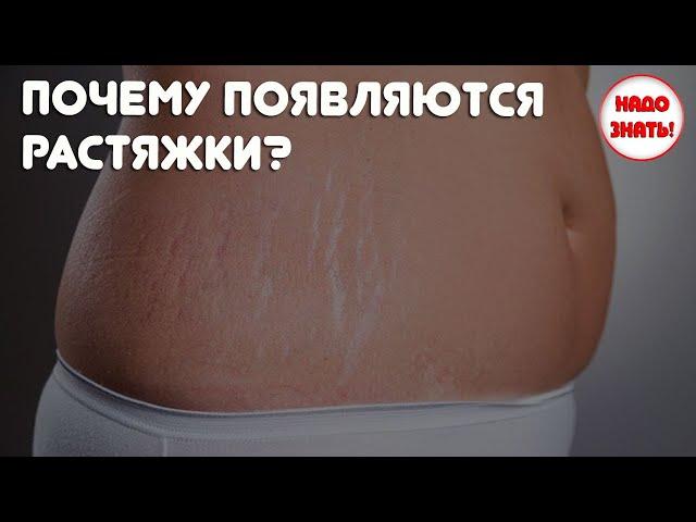 Почему появляются растяжки — основные причины?