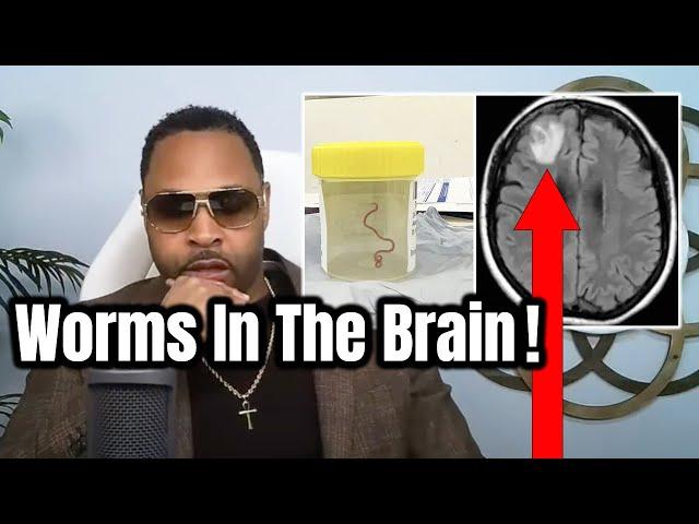 Scientists prove parasitic worms in the brain (mind control exposed)