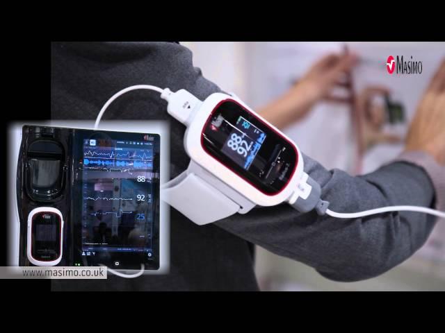 Masimo's revolutionizing pulse oximetry and noninvasive patient monitoring