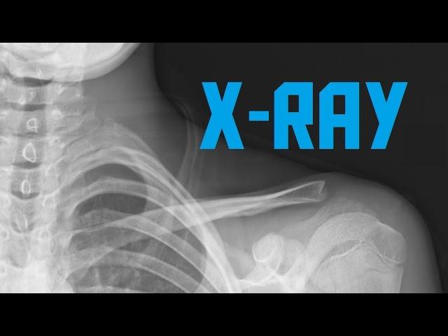 How does x-ray work? (AKIO TV)