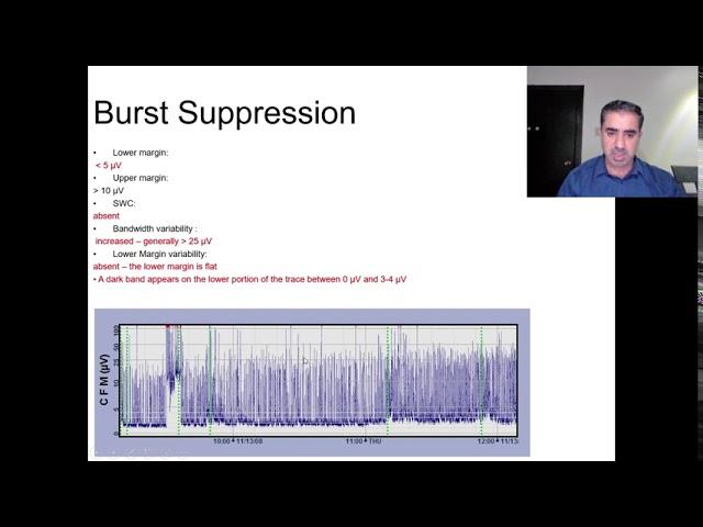 Amplitude integrated EEG aEEG made easy