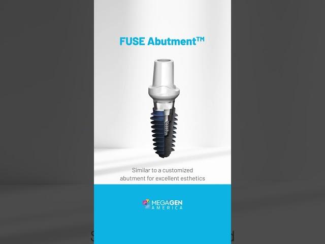 Fuse Abutment® - Better break than fail