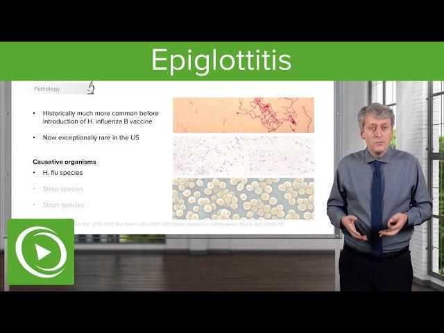 Infections of the Upper Pediatric Airway: Epiglottitis – Pediatric Infectious Diseases | Lecturio