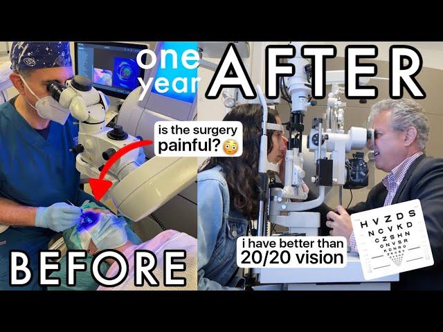 I had laser eye surgery at the best clinic in London - 1 year review (SMILE surgery)