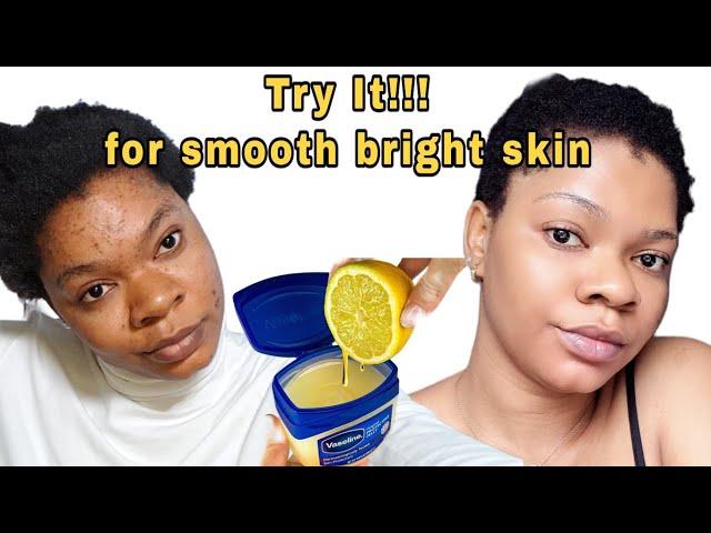 How to get smooth bright skin at home, Use Vaseline and lime for bright skin #skincare #acne #scar