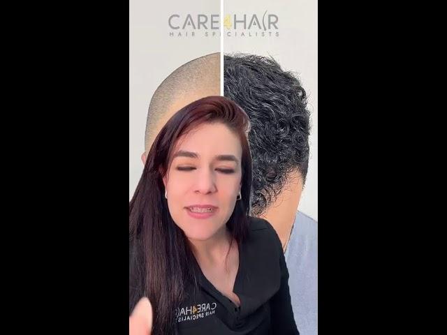 Care4Hair Transplante Capilar - Consulta Gratis