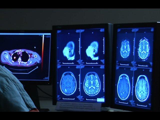 Brandi Chastain and WWE Star Kevin Nash Will Donate Their Brains to Research