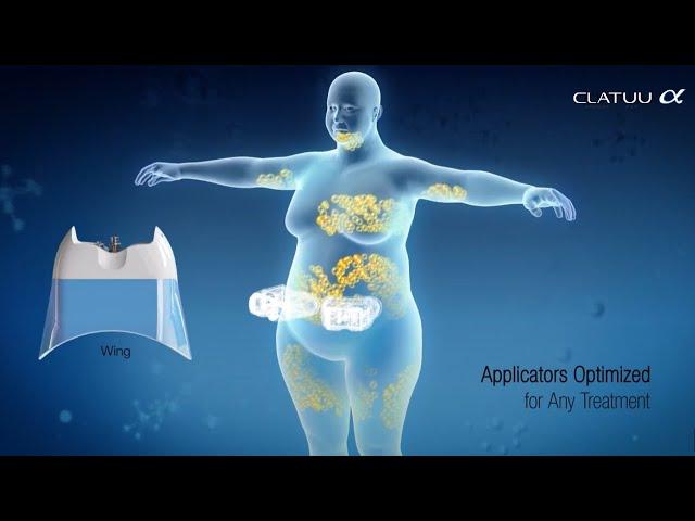 The best non-surgical fat reduction with Clatuu Alpha