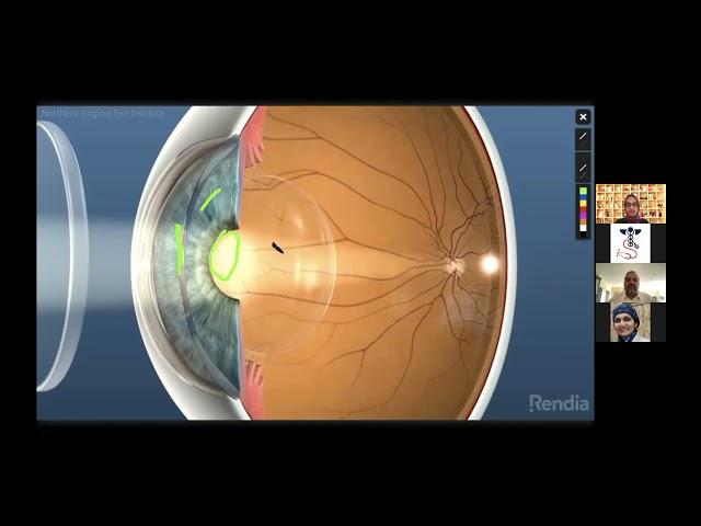 Anatomy of the Eye | TeleShadowing