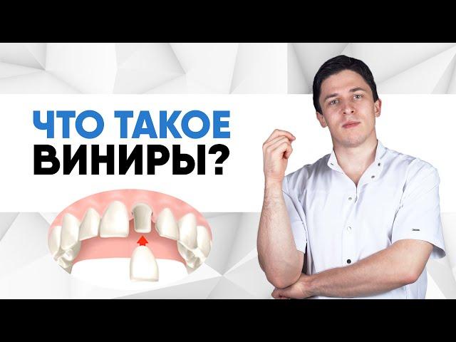 Что такое виниры?