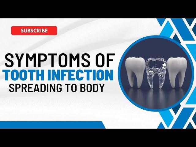 Tooth Infection Spreads: Recognizing the Symptoms and What to Do