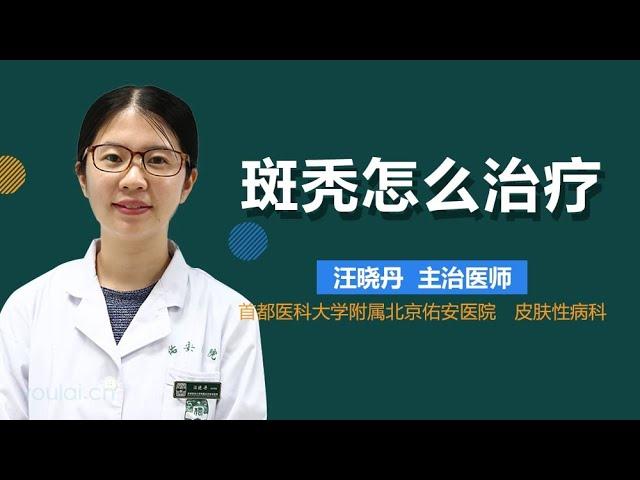 斑秃怎么治疗 有来医生