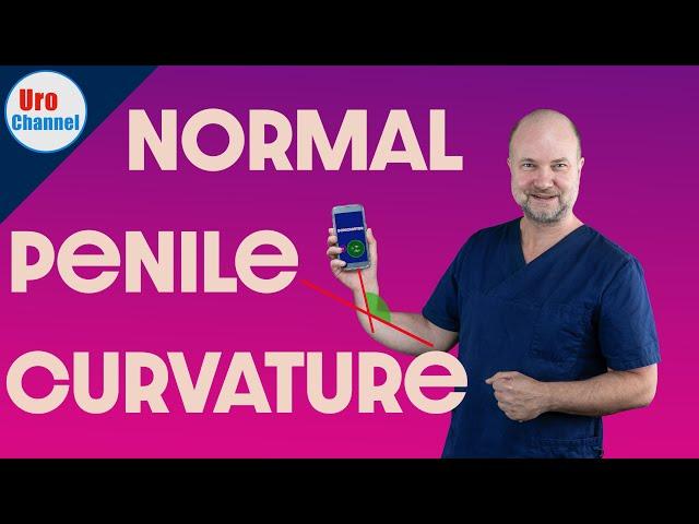 Normal penile curvature vs. Peyronie‘s vs. Chordee | UroChannel