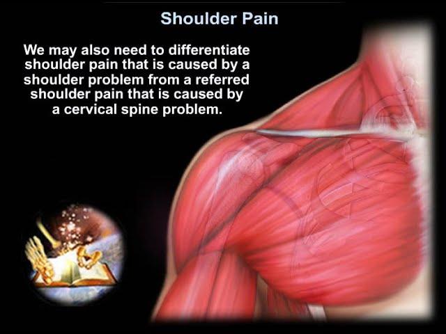 Shoulder Pain - Everything You Need To Know - Dr. Nabil Ebraheim