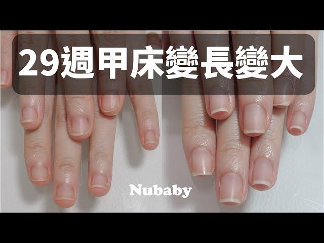 Nail shrinkage - corrected into slender manicure, biting nails Nail short and wide to become a nail