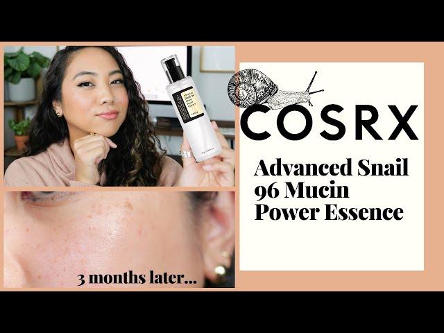 COSRX SNAIL MUCIN ESSENCE: MUST WATCH BEFORE YOU BUY | REVIEW + DEMO ON COMBINATION SKIN