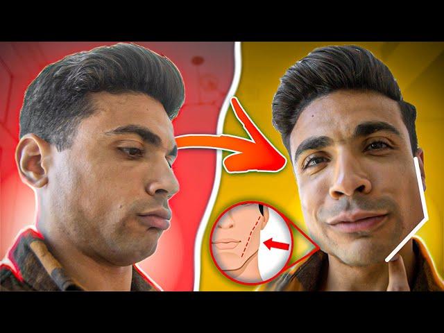 ازاي يبقى عندك فك قوي - Jawline tips