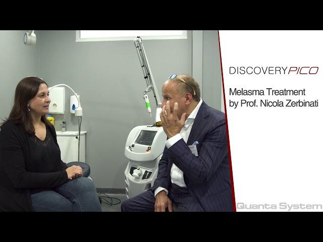 Melasma Treatment using the Discovery Pico By Prof.Nicola Zerbinati