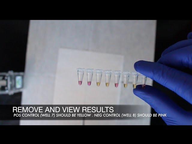 youPCR Gender Detection Protocol