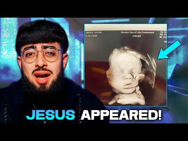 MIRACLE: Hand of God CAUGHT On Baby's Ultrasound!